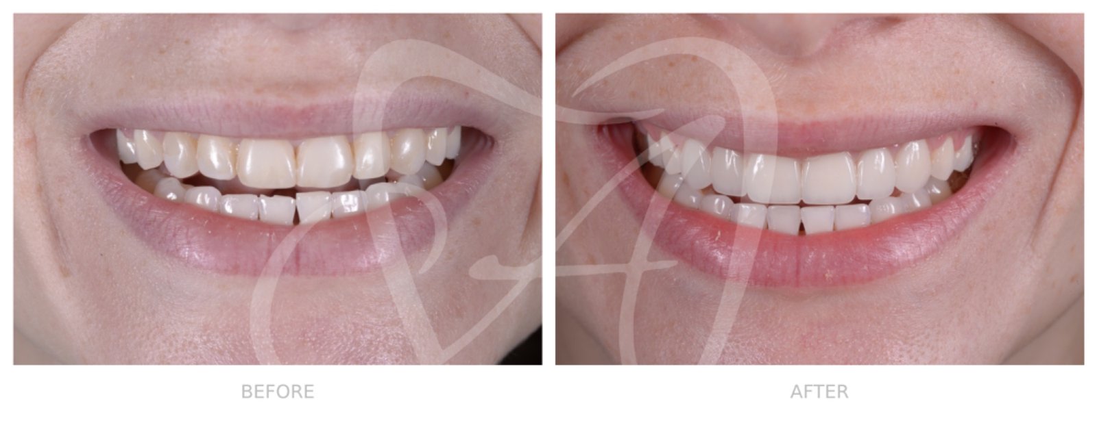 Before and After Dental Transformation 7