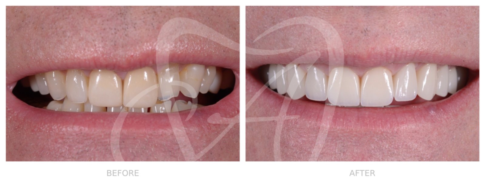 Before and After Dental Transformation 3