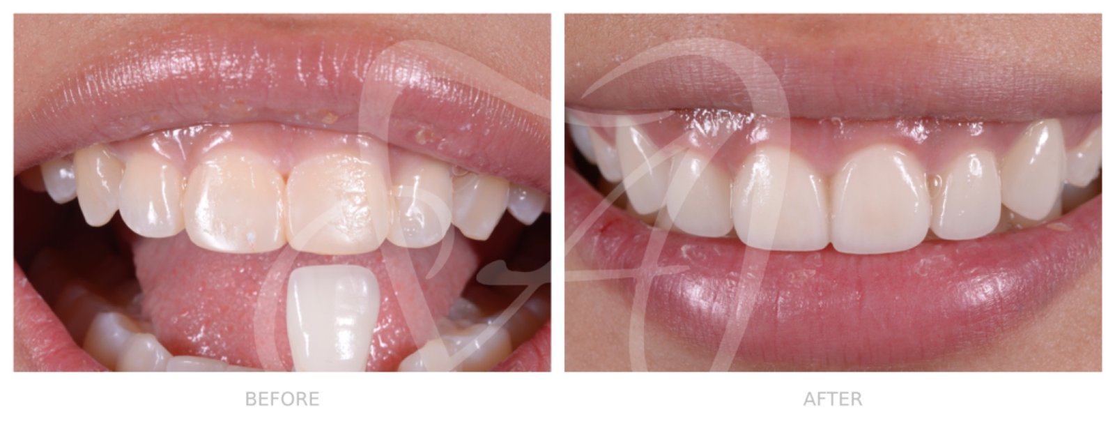 Before and After Dental Transformation 6